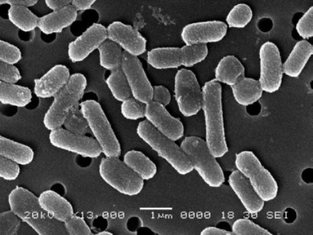 Микрофотография бактерий рода Lactobacillus plantarum.jpg